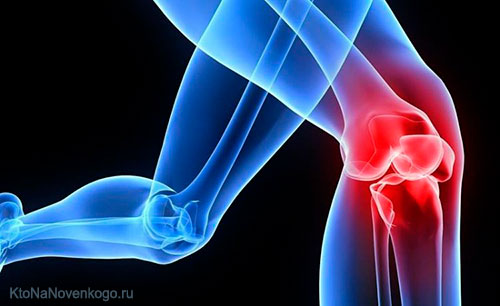 artroza koljena nego ublažavanje akutne boli)